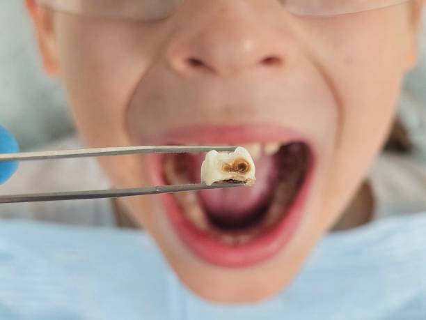 Best Broken Tooth Emergency  in Tok, AK